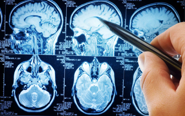 A Careggi sotto attacco epilessie e apnee notturne